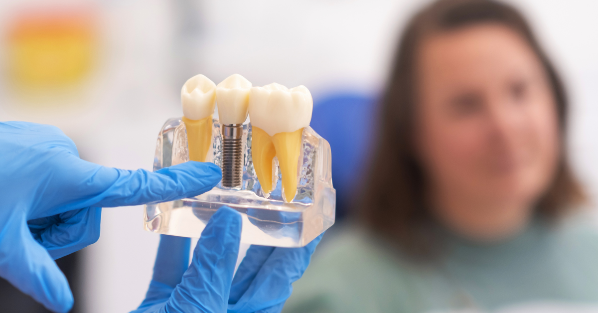 Caring for your dental implants: Tips for long-term maintenance