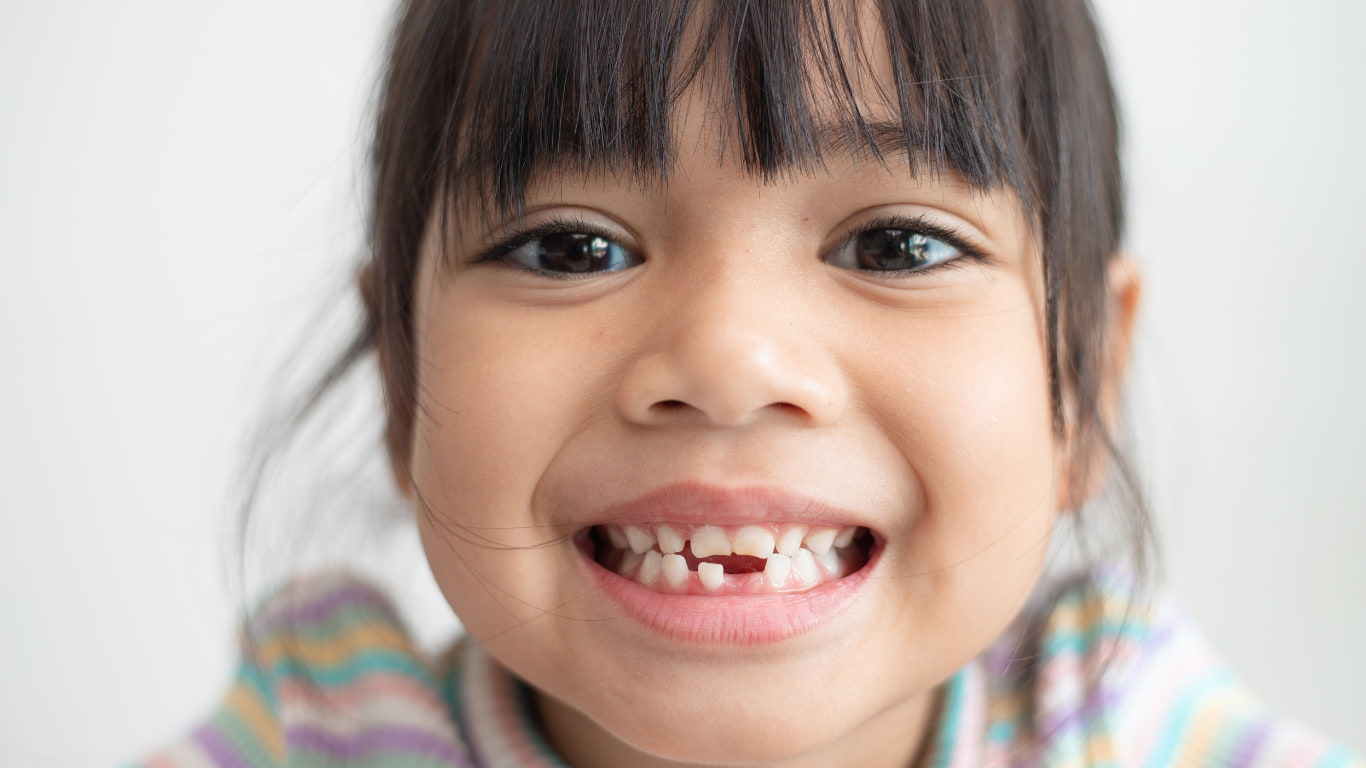 Pediatric Dentistry Kottayam
