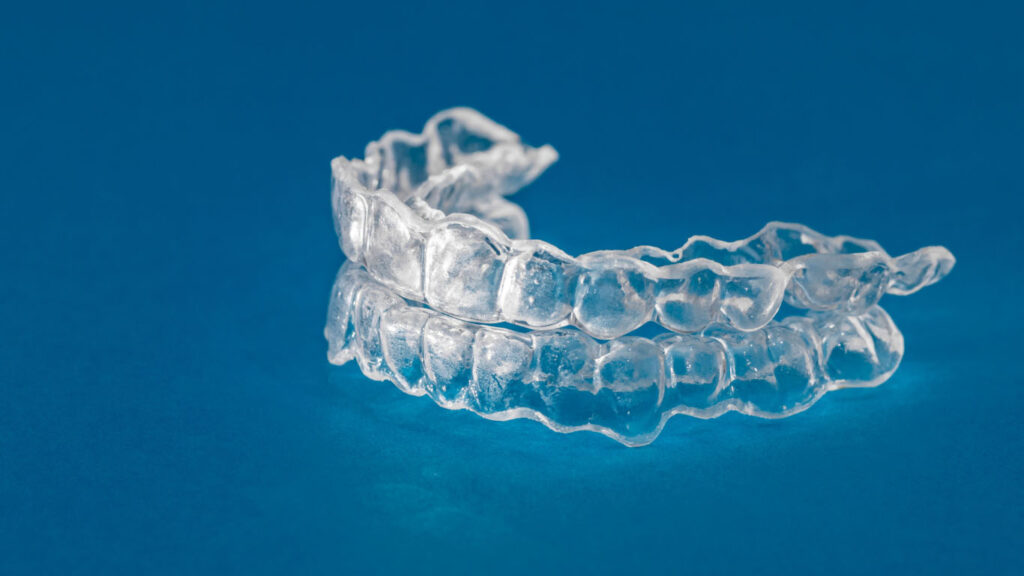Clear aligners/Invisalign Kottayam